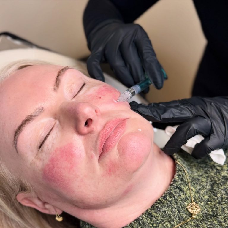 587961454_17850841236595393_6081680334648132751_n